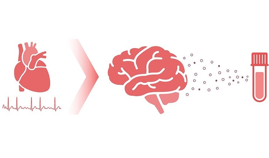 Image: A brain biomarker in blood samples can predict stroke (Photo courtesy of Karl Sjölin/Uppsala University)